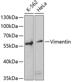 Vimentin Rabbit polyclonal antibody