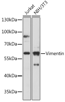 Vimentin Rabbit polyclonal antibody