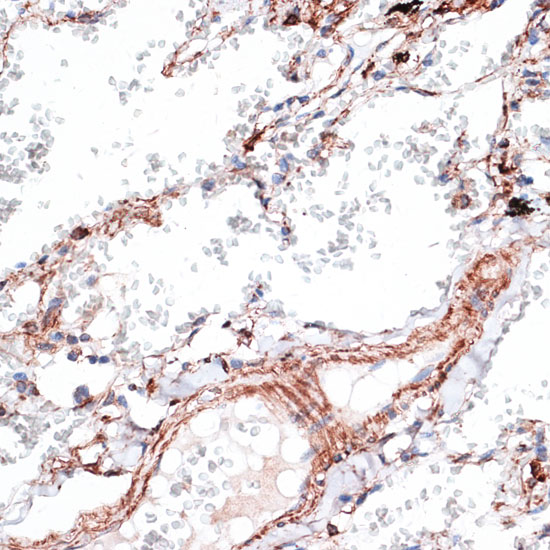 Vimentin Rabbit polyclonal antibody