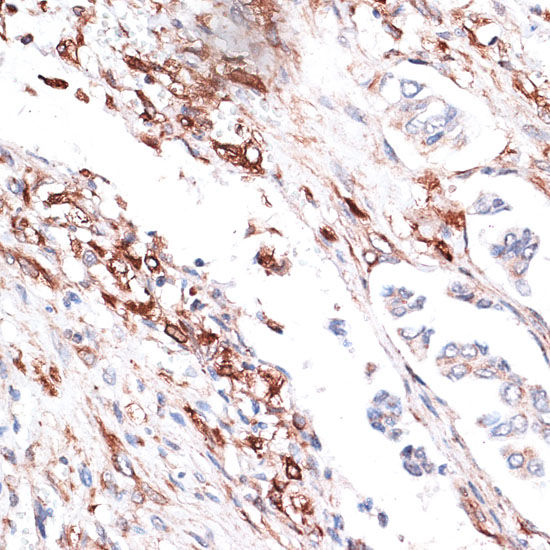 Vimentin Rabbit polyclonal antibody