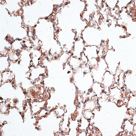 Vimentin Rabbit polyclonal antibody
