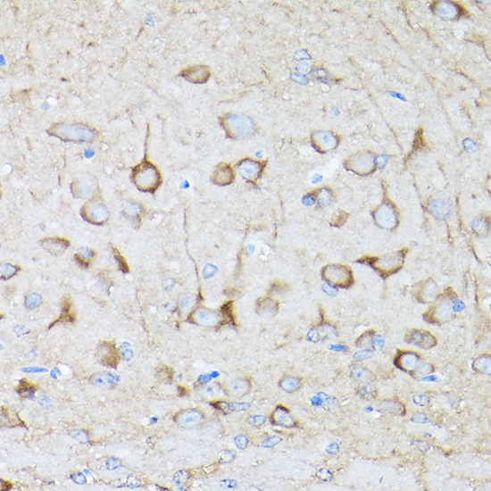 DRP1 Rabbit polyclonal antibody