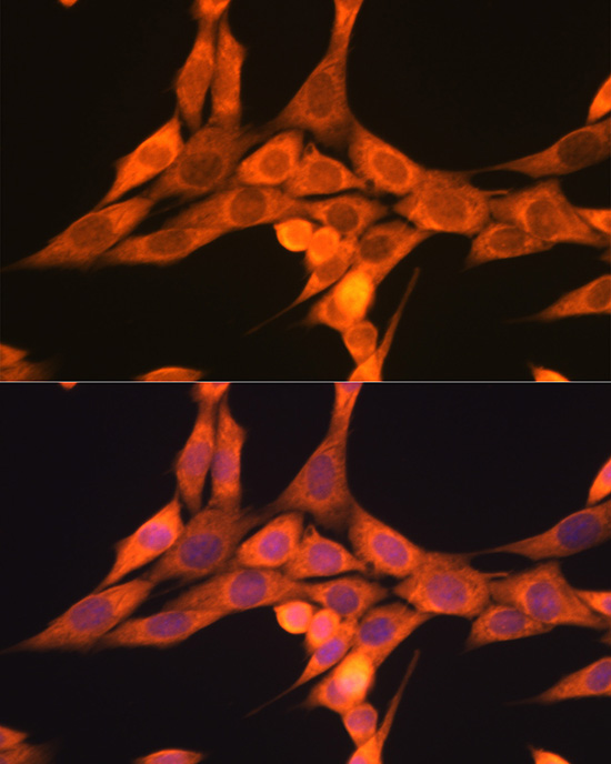 DRP1 Rabbit polyclonal antibody