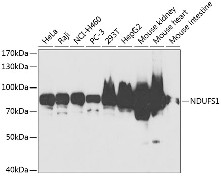 NDUFS1 Rabbit polyclonal antibody