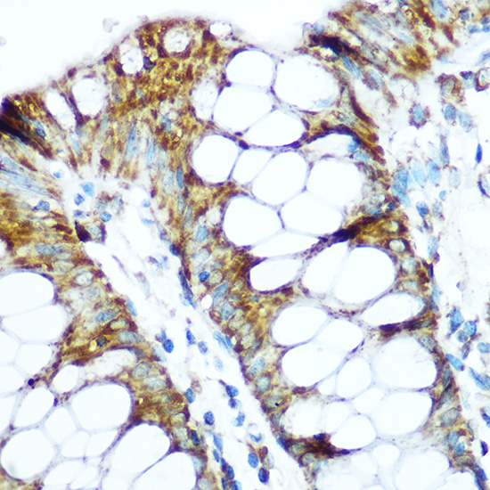 NDUFS1 Rabbit polyclonal antibody