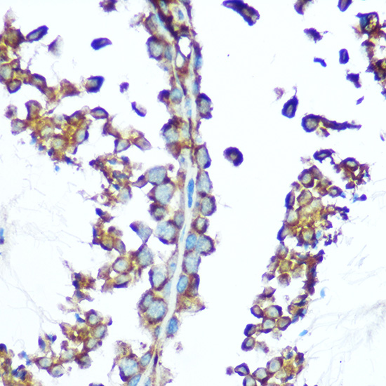 NDUFS1 Rabbit polyclonal antibody