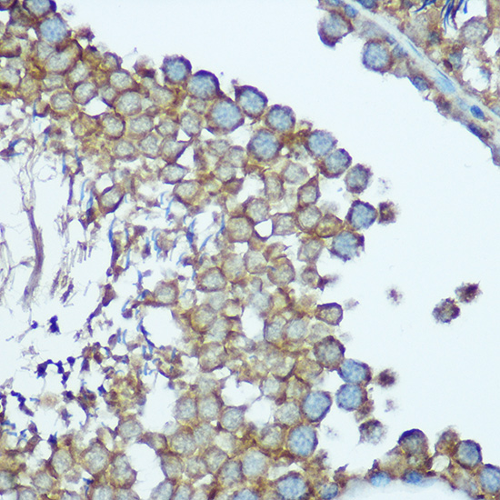 NDUFS1 Rabbit polyclonal antibody