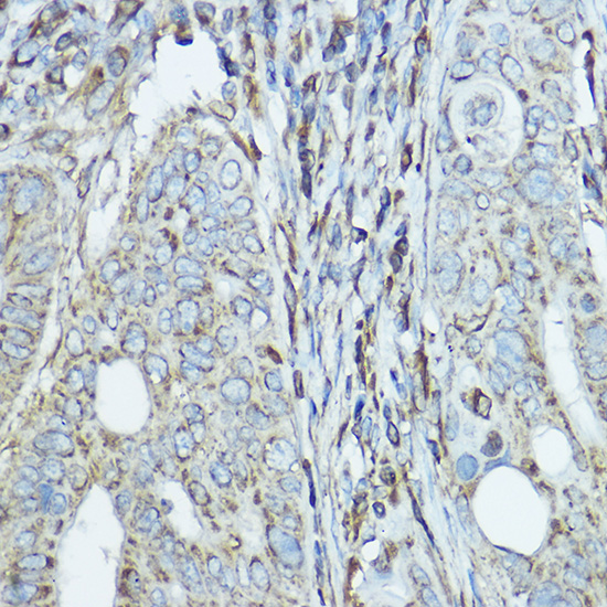 SDHA Rabbit polyclonal antibody
