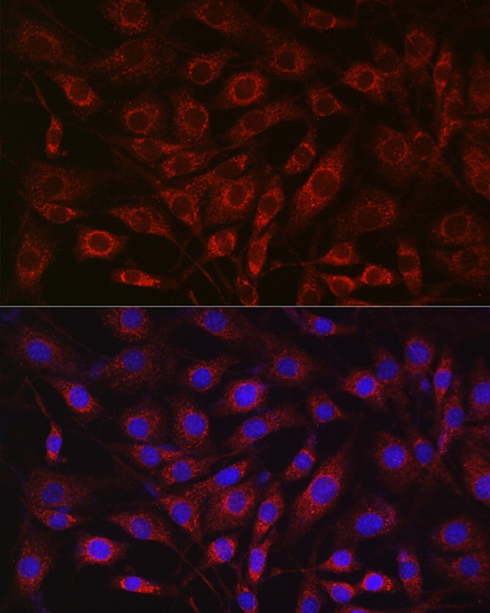SDHA Rabbit polyclonal antibody
