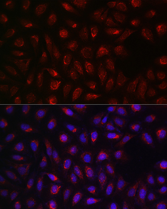 SDHA Rabbit polyclonal antibody