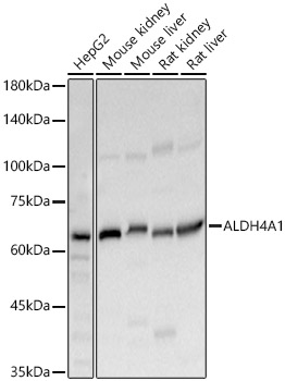 ALDH4A1 Rabbit polyclonal antibody