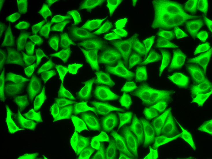 ALDH4A1 Rabbit polyclonal antibody