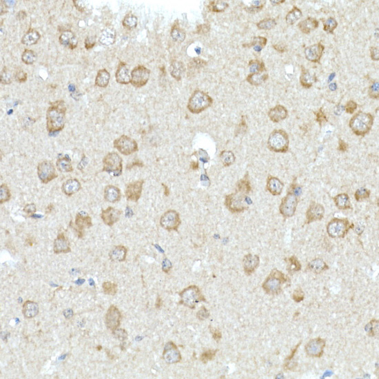 RHOT2 Rabbit polyclonal antibody