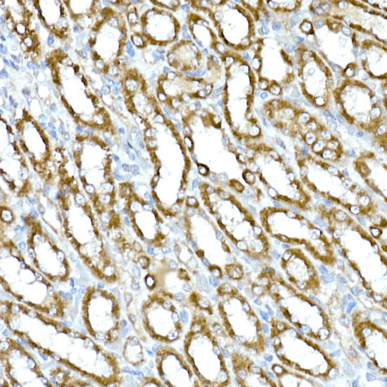 RHOT2 Rabbit polyclonal antibody