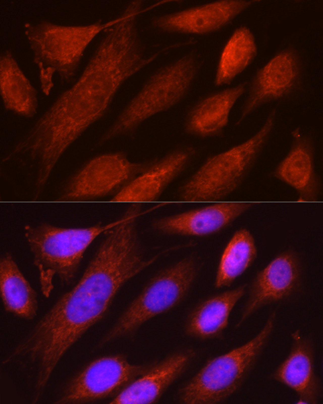 RHOT2 Rabbit polyclonal antibody