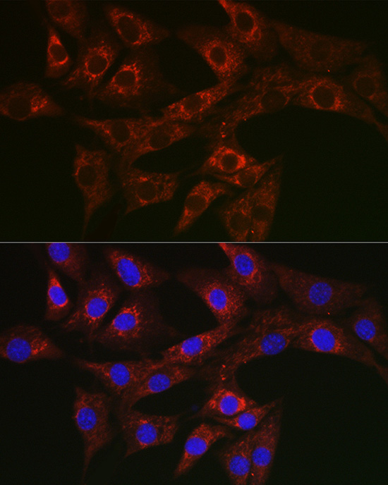 ATG4A Rabbit polyclonal antibody