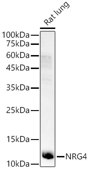 NRG4 Rabbit polyclonal antibody
