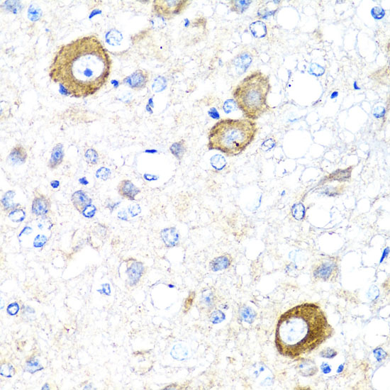 NRG4 Rabbit polyclonal antibody