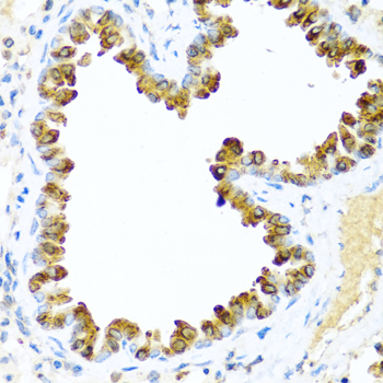 NRG4 Rabbit polyclonal antibody