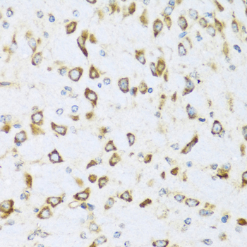 NRG4 Rabbit polyclonal antibody