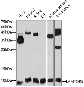 LAMTOR5 Rabbit polyclonal antibody