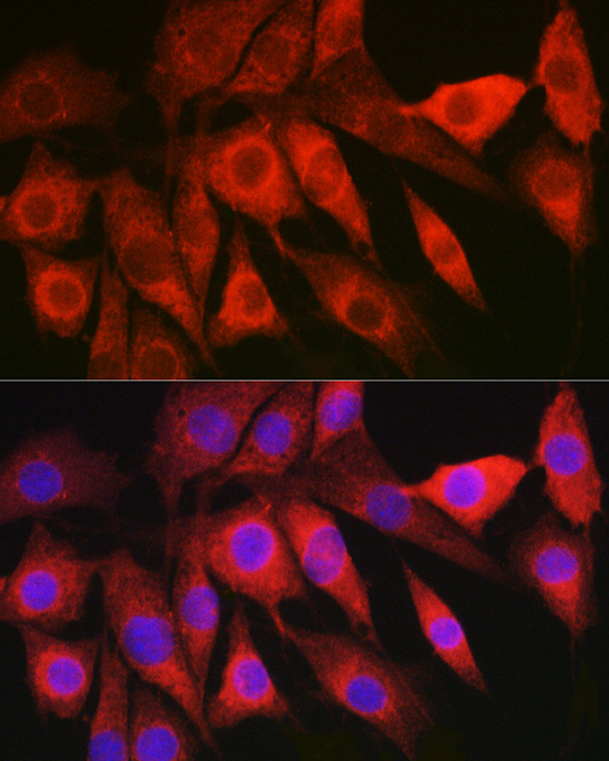 LAMTOR5 Rabbit polyclonal antibody