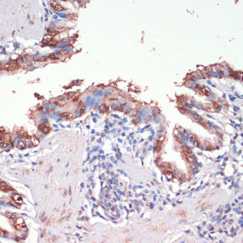 Musashi-1 (MSI1) Rabbit polyclonal antibody