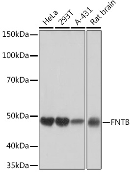 FNTB Rabbit monoclonal antibody