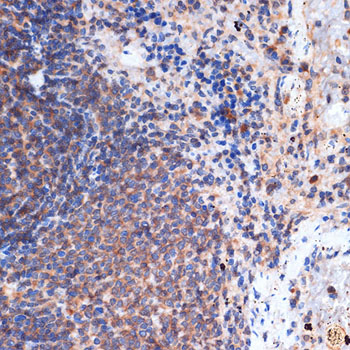 FNTB Rabbit monoclonal antibody