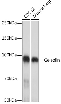 Gelsolin Rabbit monoclonal antibody