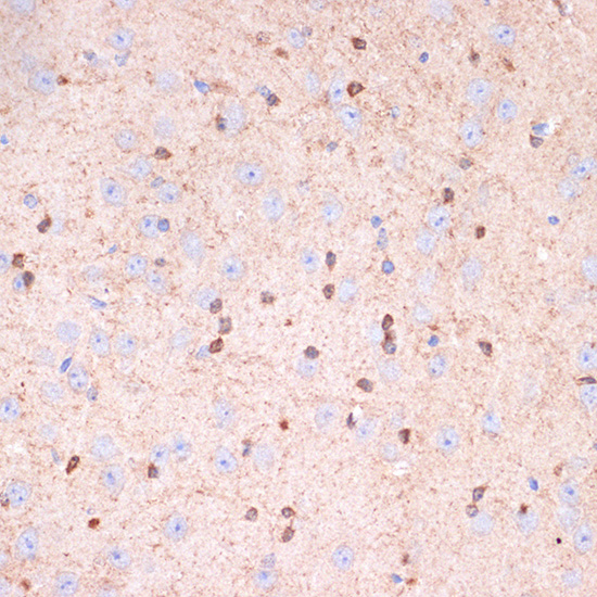 Gelsolin Rabbit monoclonal antibody