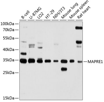 MAPRE1 Rabbit polyclonal antibody