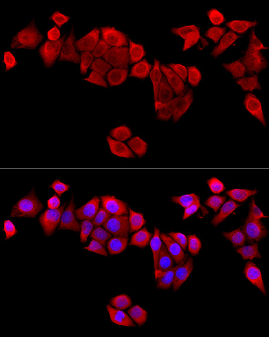 MAPRE1 Rabbit polyclonal antibody