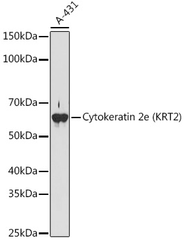 Cytokeratin 2e (KRT2) Rabbit monoclonal antibody