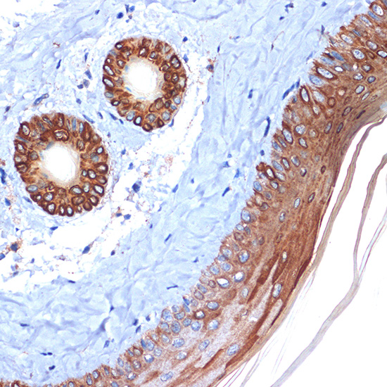 Cytokeratin 2e (KRT2) Rabbit monoclonal antibody