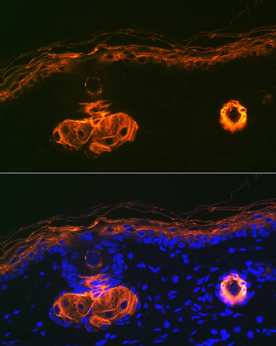 Cytokeratin 2e (KRT2) Rabbit monoclonal antibody