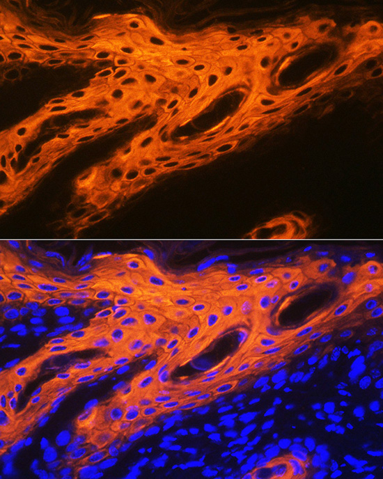 Cytokeratin 2e (KRT2) Rabbit monoclonal antibody