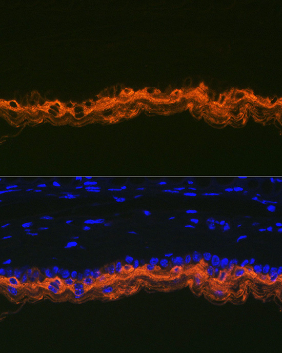 Cytokeratin 2e (KRT2) Rabbit monoclonal antibody