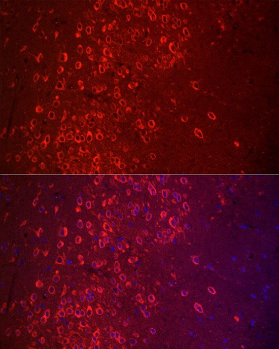 APLP1 Rabbit polyclonal antibody