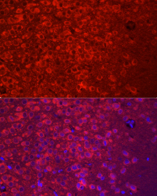 APLP1 Rabbit polyclonal antibody