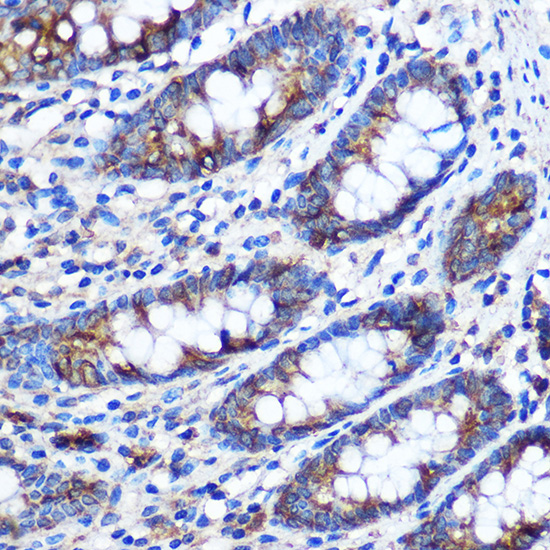 STAT4 Rabbit polyclonal antibody