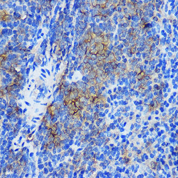 STAT4 Rabbit polyclonal antibody