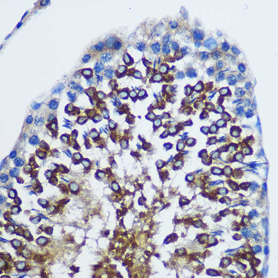 STAT4 Rabbit polyclonal antibody