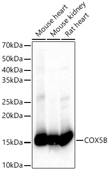 COX5B Rabbit polyclonal antibody