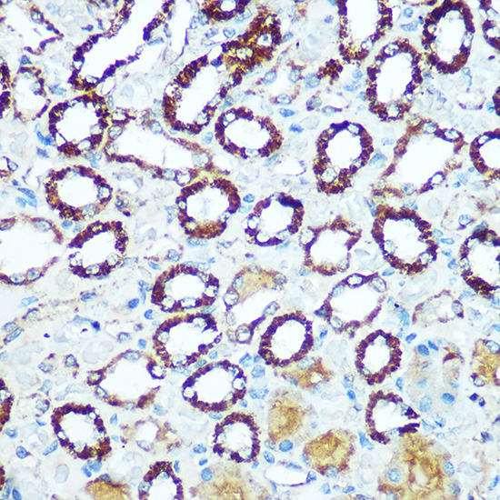 COX5B Rabbit polyclonal antibody
