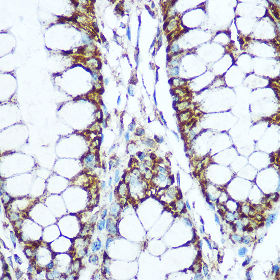 COX5B Rabbit polyclonal antibody