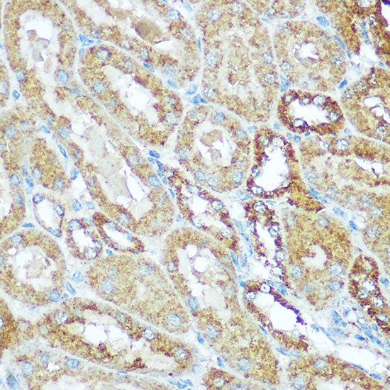 COX5B Rabbit polyclonal antibody