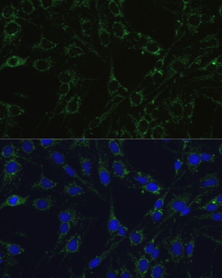 COX5B Rabbit polyclonal antibody