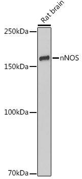 nNOS Rabbit monoclonal antibody