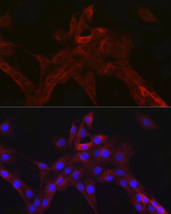 nNOS Rabbit monoclonal antibody